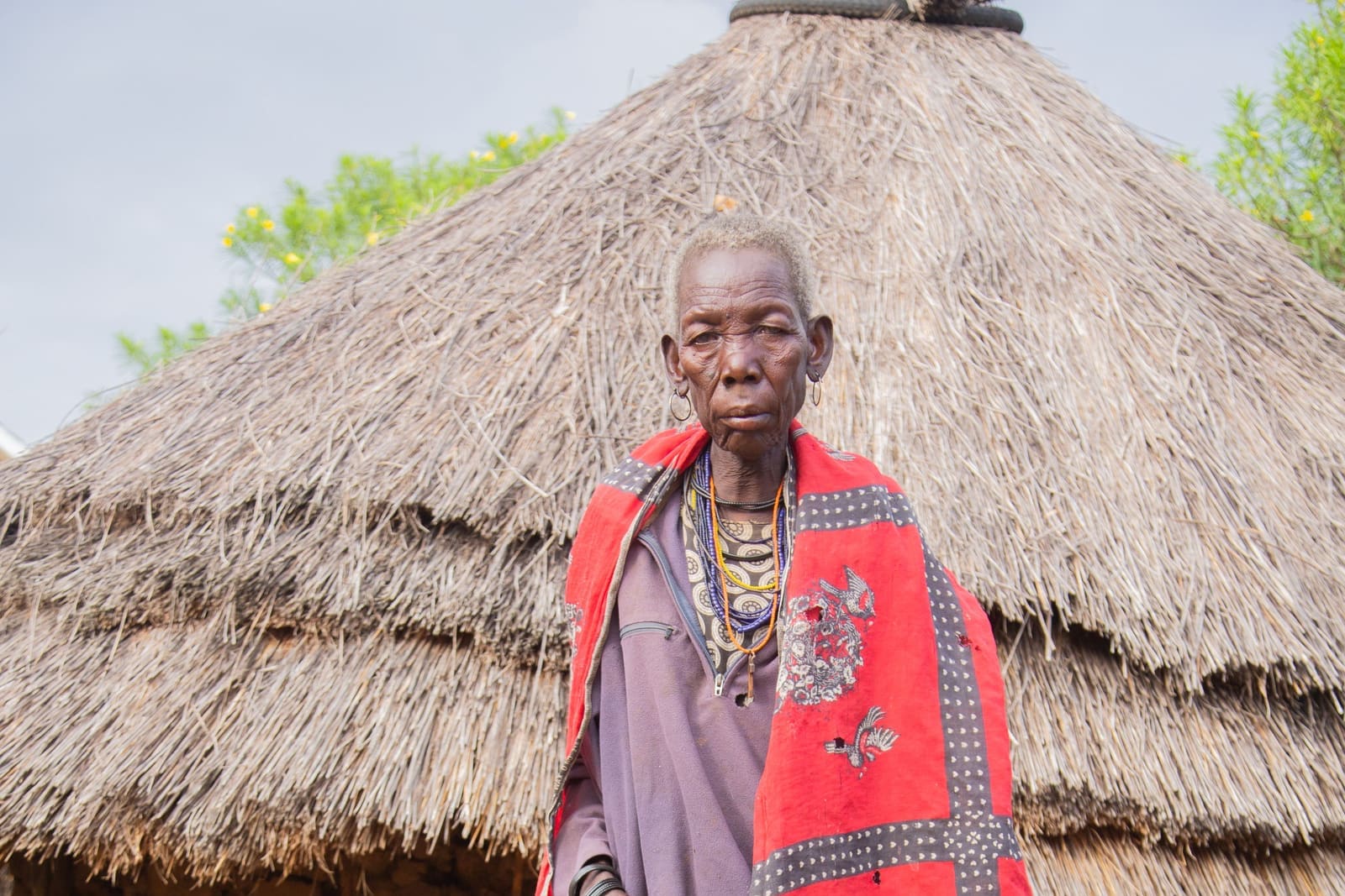 The Village Eye — How Traditional Healers and Modern Eye Care Can Work Together